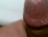 dick close up