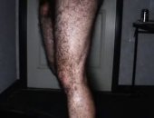 My Hairy Legs -- By Several Requests.